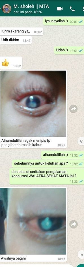 Resep Obat Mata