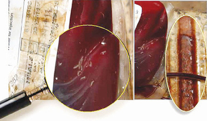 Auditors find blood with maggots in hospitals | Trending in Uganda | Scoop.it