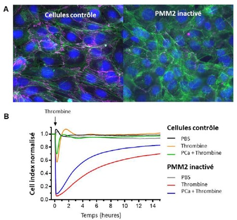 Quel est l’impact d’un défaut de glycosylation sur le système de la protéine C et la barrière endothéliale ? | Life Sciences Université Paris-Saclay | Scoop.it