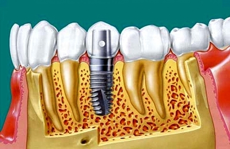 L'implantation de la motion La Droite Sociale (LDS) | Chronique des Droits de l'Homme | Scoop.it