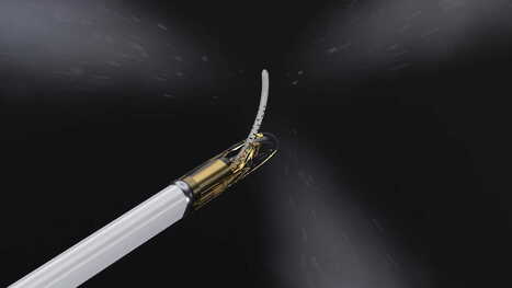 IR Update: FDA Clears Emerging Prostate Tissue Ablation System for Intermediate Risk PCa | Diagnostic Imaging | Health Device News | Scoop.it