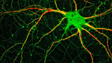 Le cerveau sur &eacute;coute gr&acirc;ce &agrave; l&rsquo;IRM de diffusion | Life Sciences Universit&eacute; Paris-Saclay | Scoop.it