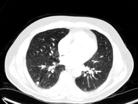 Study: Most radiologists don’t notice a gorilla in a CT scan | 21st Century Innovative Technologies and Developments as also discoveries, curiosity ( insolite)... | Scoop.it