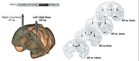 La quantification de l&rsquo;imagerie c&eacute;r&eacute;brale TEP &agrave; l&rsquo;&eacute;preuve de l&rsquo;histologie 3D | Life Sciences Universit&eacute; Paris-Saclay | Scoop.it
