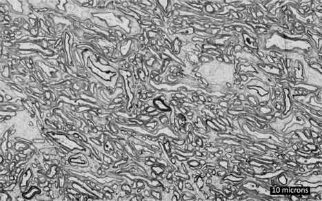 Technologies to enable whole-brain nanoscale preservation and imaging | Amazing Science | Scoop.it
