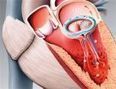 À la croisée des arts et des sciences, l’illustration médicale | Culture scientifique et technique | Scoop.it