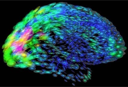 The Human Brain --"Will it Prove to be the Most Complex Mass of Protoplasm in the Milky Way?" (Today's Most Popular) | Science News | Scoop.it