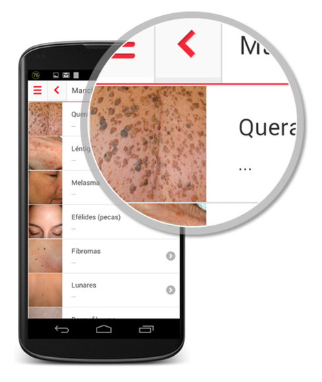 Una app española para autoexplorarse la piel | I didn't know it was impossible.. and I did it :-) - No sabia que era imposible.. y lo hice :-) | Scoop.it
