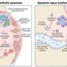 Rheumatology-Rhumatologie