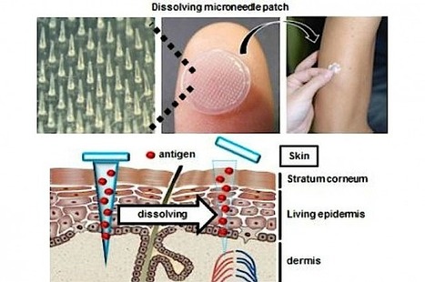 Dissolvable Microneedles Beat Flu Vaccine Injection | Intra-Dermal drug delivery: Opportunities and Challenges? | Scoop.it
