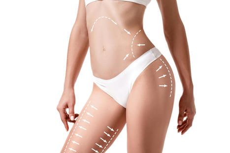 What is Liposuction? | Navigating Healthcare | Medical and Health | Scoop.it