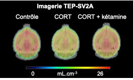 L’imagerie TEP révèle les effets de kétamine sur la plasticité synaptique dans un modèle de dépression | Life Sciences Université Paris-Saclay | Scoop.it