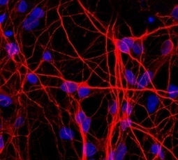 Brain cells made from urine | KurzweilAI | Longevity science | Scoop.it