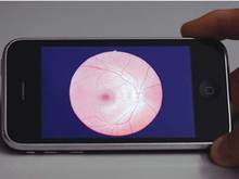 Les smartphones pourraient servir aux diagnostics oculaires | M-HEALTH  By PHARMAGEEK | Scoop.it