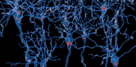 Maladie &agrave; corps de Lewy&nbsp;: quelle est cette maladie neurocognitive fr&eacute;quente, mais peu connue, qui a emport&eacute; Nathalie Baye&nbsp;? (The Conversation) | GRIEPS | Scoop.it