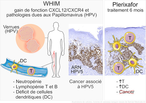 La chimiokine CXCL12 et son récepteur CXCR4 dans la pathogenèse des HPV : le traitement d'un patient par un antagoniste de CXCR4 permet la disparition d’un carcinome anal causé par un HPV cutané | Life Sciences Université Paris-Saclay | Scoop.it