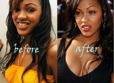 Photo for meagan good plastic surgery
