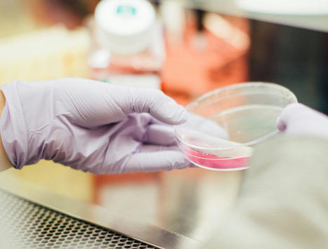 Recreando tumores en el laboratorio: los cultivos 3D - AcercaCiencia | Enfermedades y Salud | Scoop.it
