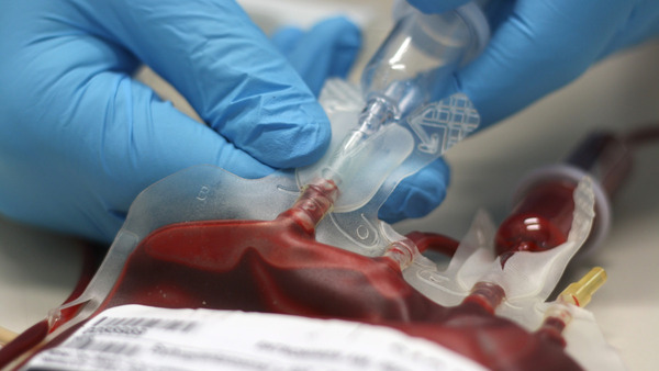 Incidence and costs of bleeding-related complications in French hospitals following surgery for various diagnoses | Interventional Cardiology | Scoop.it