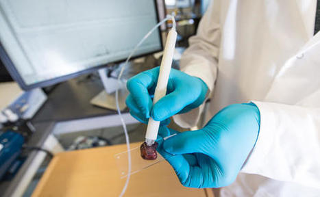 Stift erkennt, ob Tumor gut- oder bösartig ist | #Research #Cancer #Technology | 21st Century Innovative Technologies and Developments as also discoveries, curiosity ( insolite)... | Scoop.it