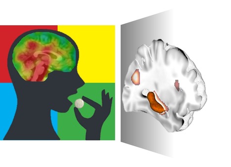 FOCUS PLATEFORME : L’imagerie du lithium à très haut champ magnétique révèle son accumulation dans l’hippocampe chez les patients souffrant de trouble bipolaire | Life Sciences Université Paris-Saclay | Scoop.it