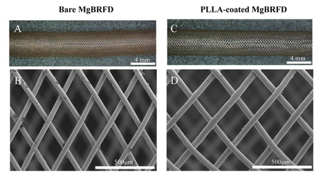 Magnesium-based bioresorbable flow diverter for intracranial aneurysms: a pilot study of biocompatibility and bioresorption in a rabbit vascular model | Neurovascular Intervention | Scoop.it