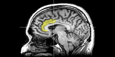 Neuroimaging study reveals hate speech dulls brain's empathy responses | Empathy Movement Magazine | Scoop.it