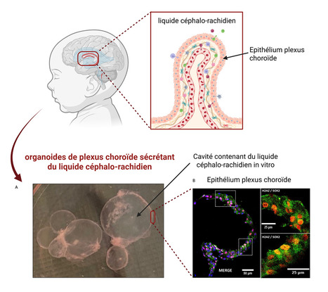 Un mod&egrave;le in&eacute;dit de plexus choro&iuml;de r&eacute;v&egrave;le de nouveaux biomarqueurs de l&rsquo;hypoxie c&eacute;r&eacute;brale | Life Sciences Universit&eacute; Paris-Saclay | Scoop.it
