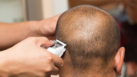 Video Those Bumps On Your Head May Be More Se