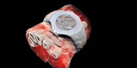 See Bones, Blood and Tissue in World's First 3D Colored X-Ray | iPads, MakerEd and More  in Education | Scoop.it