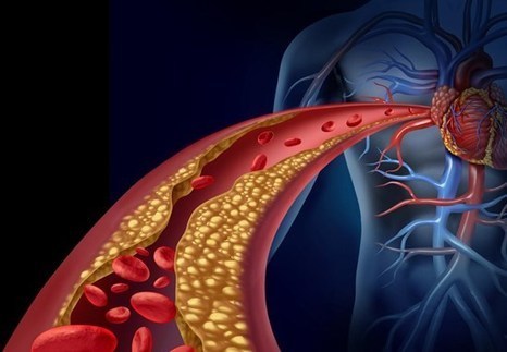 Cholestérol : 10 choses qu’on ne vous dit pas | ITERG - Nutrition, Santé et Biochimie des Lipides | Scoop.it