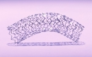 Medtronic, Abbott awarded first SharedClarity contracts | Interventional Cardiology | Scoop.it
