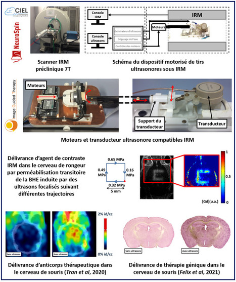 FOCUS PLATEFORME : Comment délivrer des molécules thérapeutiques dans le cerveau grâce à un dispositif d’ultrasons focalisés sous guidage IRM ? | Life Sciences Université Paris-Saclay | Scoop.it