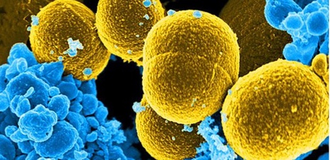 Targeting metals to fight pathogenic bacteria | Bioscience News - GEG Tech top picks | Scoop.it