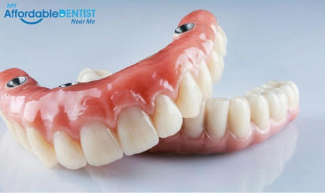 Discover the Power of Dental Dentures for a Confident Smile | My Affordable Dentist Near Me | Scoop.it