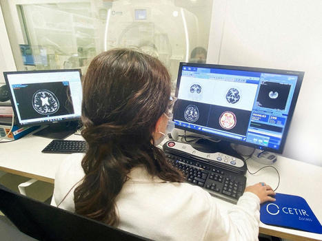 Identifican nuevos genes que modulan la toxicidad de la proteína beta-amiloide, responsable de causar Alzheimer | Alzheimer y más (Boletín nº 76) | Scoop.it