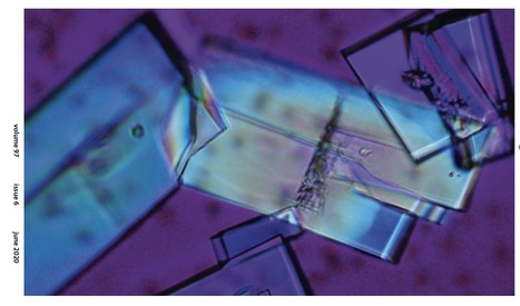 ICP science - The Case | Fluctuating serum creatinine and crystals in urine | Infos Lab' juin 2025 | Scoop.it