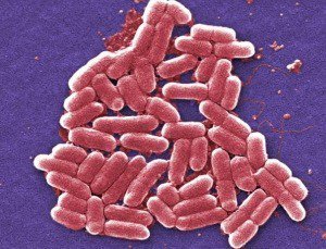 [Actualit&eacute; - Mai/Juin 2011] R&eacute;sum&eacute; des liens sur la bact&eacute;rie Escherichia coli O104:H4 | Microbiologie | Scoop.it