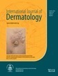 The significance of hypersensitivity to autologous sweat and serum in cholinergic urticaria: cholinergic urticaria may have different subtypes - Kim - 2014 - International Journal of Dermatology - ... | Allergy (and clinical immunology) | Scoop.it