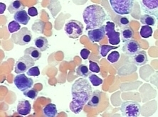 Recent advances in globin research using genome-wide association studies and gene editing | Genetic Engineering Publications - GEG Tech top picks | Scoop.it