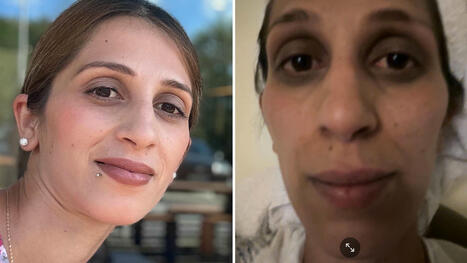 Aida, 31, fick för hög dos järn – blev svart i ansiktet | 1Uutiset - Lukemisen tähden | Scoop.it