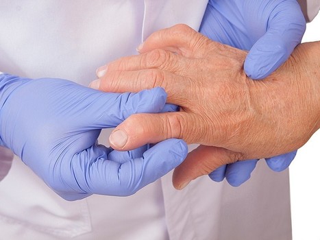 Comment les macaques mauriciens aident à comprendre les facteurs de risques génétiques de la polyarthrite rhumatoïde chez l’homme | Life Sciences Université Paris-Saclay | Scoop.it