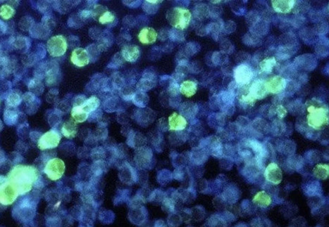 The Human DNA Virome Varies with Human Genes, Age, Gender, Circadian Patterns, and Smoking | Virus World | Scoop.it