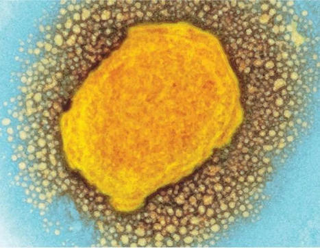 The challenge of tracking asymptomatic Mpox | Virology News | Scoop.it