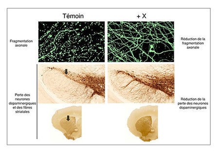 Les virus à la rescousse pour les maladies neurodégénératives ? | ITERG - Nutrition, Santé et Biochimie des Lipides | Scoop.it