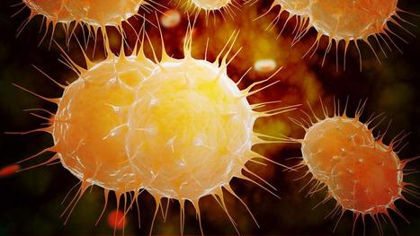 Chlamydia, gonorrhée, syphilis... Les MST, ce n'est pas que le sida | sida | Scoop.it