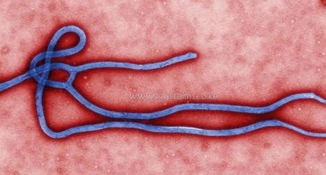 Liberian medic treated with experimental Ebola drug dies [but 2 others don't] | Plant Molecular Farming | Scoop.it