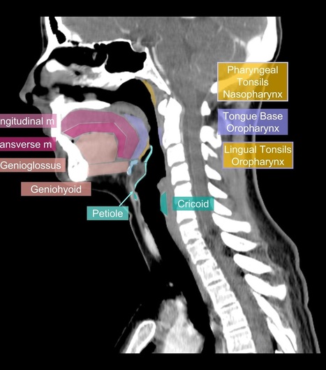 learningneuroradiology.com | Radiology | Scoop.it