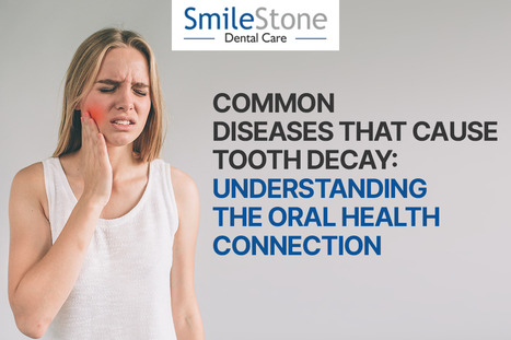 Common Diseases That Cause Tooth Decay: Understanding the Oral Health Connection | dentist | Scoop.it