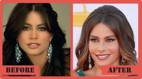 Celebrity sofia vergara plastic surgery before and after.